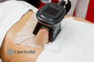 Are The Results From Aqualyx Permanent? 4 Compare Aqualyx Carlton to other fat reduction treatments.